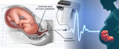 Monitorización de la frecuencia cardíaca