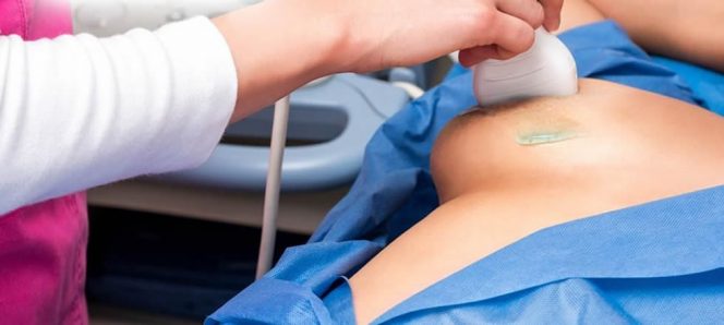 Ultrasonido de mamas: Alternativa para la detección del cáncer